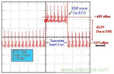 圖 1：醫(yī)用 ECG 測量設備的性能