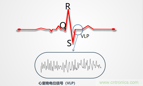 解決心電監(jiān)測(cè)行業(yè)難題，曼森伯格的濾波技術(shù)獲國(guó)家知識(shí)產(chǎn)權(quán)局發(fā)明授權(quán)