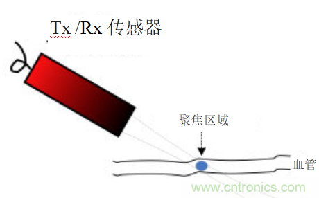 超聲系統(tǒng)的信號鏈設(shè)計注意事項